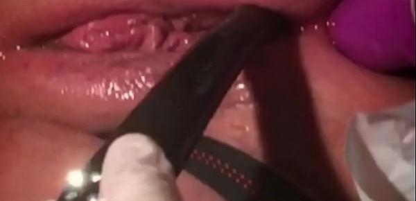 Lovely girl kinky gyno experience